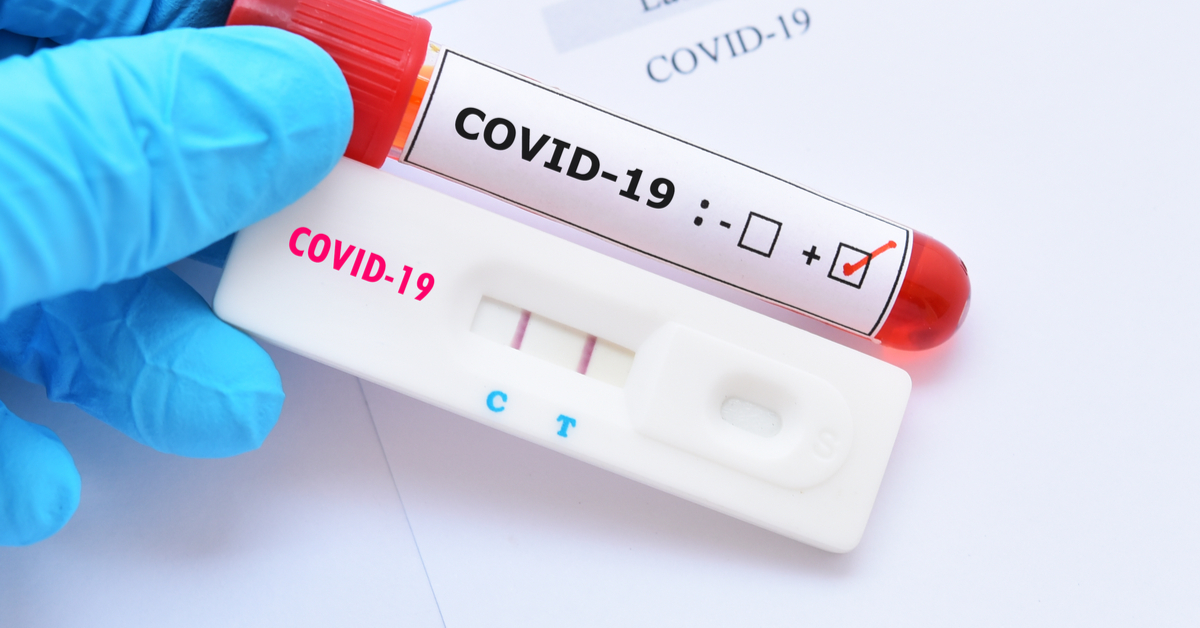 Abrafarma disponibiliza protocolo de testes de Covid-19 na farmácias