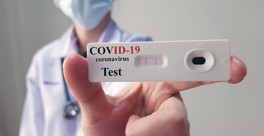 farmacias afetadas coronavirus testes rapidos