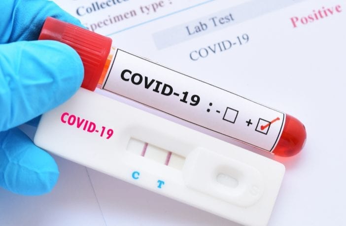 ans-derruba-cobertura-do-teste-do-coronavírus