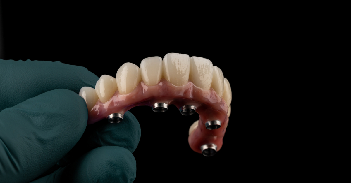 próteses-dentárias-encaixe