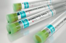 teste-monkeypox