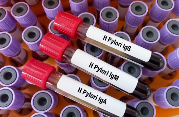 o-que-e-h-pylori-conheca-os-sintomas-e-tratamento-da-doenca