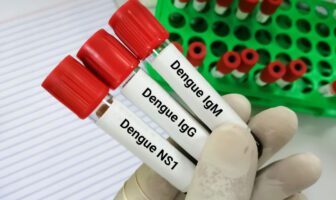 dengue-atendimentos-em-hospitais-da-rede-dor-pelo-pais-crescem-38-em-uma-semana