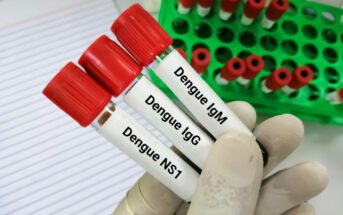 dengue-atendimentos-em-hospitais-da-rede-dor-pelo-pais-crescem-38-em-uma-semana