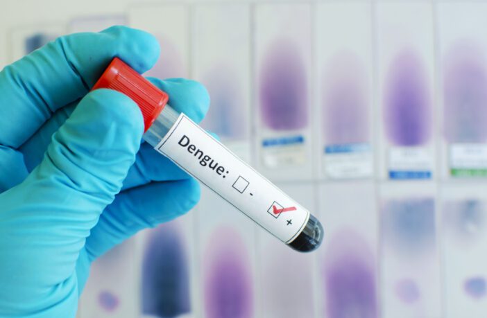 entenda-como-funcionam-os-testes-de-dengue-e-qual-o-mais-indicado-para-cada-fase-da-doenca