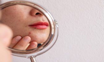 mulher-branca-olhando-no-espelho-sua-pele-com-acne