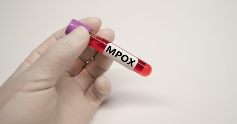 Brasil-supera-marca-de-mil-casos-de-mpox-em-2024
